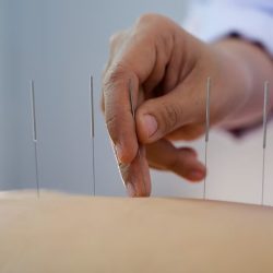 acupuncture-women-who-are-back-acupuncture-treatment-salon_35534-618.jpg acupuncture-women-who-are-back-acupuncture-treatment-salon_35534-618.jpg